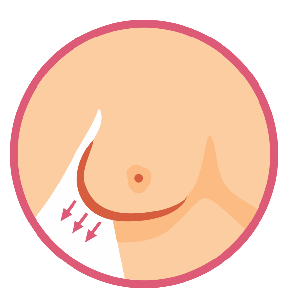 Change in the size, shape or color